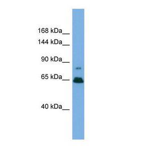 ZNF676 Antibody - Western blot of Human HepG2. ZNF676 antibody dilution 1.0 ug/ml.  This image was taken for the unconjugated form of this product. Other forms have not been tested.