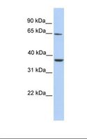 ZNF677 Antibody - Fetal liver lysate. Antibody concentration: 1.0 ug/ml. Gel concentration: 12%.  This image was taken for the unconjugated form of this product. Other forms have not been tested.