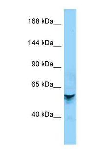 ZNF678 Antibody - Western blot of Human OVCAR-3. ZNF678 antibody dilution 1.0 ug/ml.  This image was taken for the unconjugated form of this product. Other forms have not been tested.