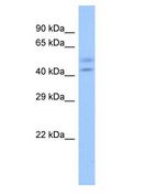 ZNF679 Antibody - ZNF679 antibody Western Blot of Fetal Heart. Antibody dilution: 1 ug/ml.  This image was taken for the unconjugated form of this product. Other forms have not been tested.