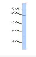 ZNF680 Antibody - 721_B cell lysate. Antibody concentration: 1.0 ug/ml. Gel concentration: 12%.  This image was taken for the unconjugated form of this product. Other forms have not been tested.