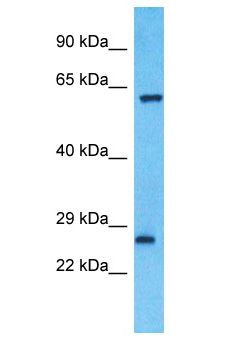 ZNF680 Antibody - ZNF680 antibody Western Blot of Jurkat. Antibody dilution: 1 ug/ml.  This image was taken for the unconjugated form of this product. Other forms have not been tested.