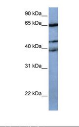 ZNF681 Antibody - 721_B cell lysate. Antibody concentration: 1.0 ug/ml. Gel concentration: 12%.  This image was taken for the unconjugated form of this product. Other forms have not been tested.