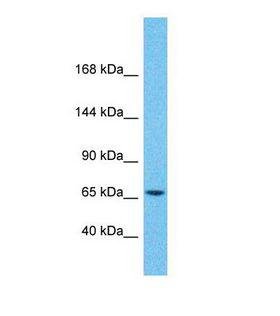 ZNF681 Antibody - Western blot of Human Pancreas Tumor. ZNF681 antibody dilution 1.0 ug/ml.  This image was taken for the unconjugated form of this product. Other forms have not been tested.