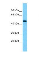 ZNF682 Antibody - Western blot of Human Pancreas Tumor. ZNF682 antibody dilution 1.0 ug/ml.  This image was taken for the unconjugated form of this product. Other forms have not been tested.