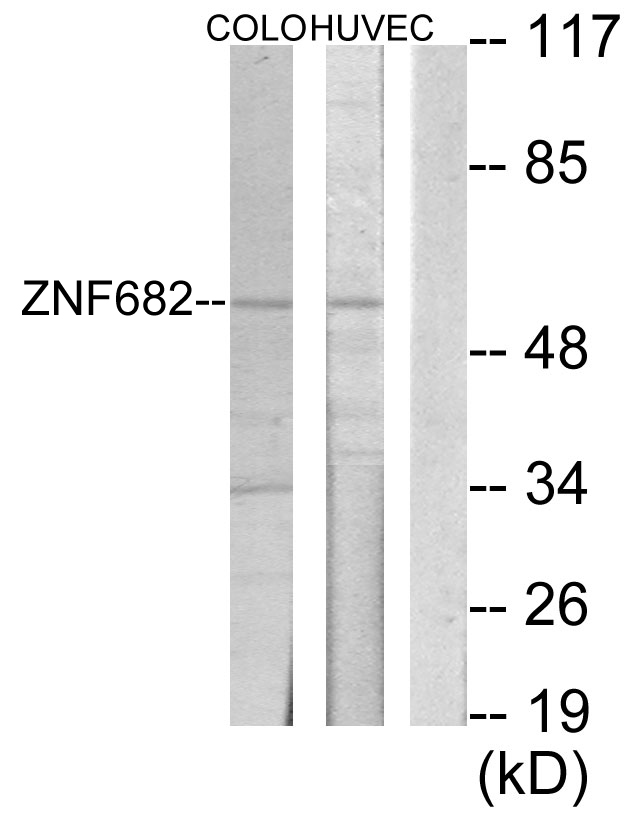 ZNF682 Antibody - Western blot analysis of lysates from COLO205 and HUVEC cells, using ZNF682 Antibody. The lane on the right is blocked with the synthesized peptide.