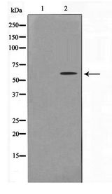 ZNF682 Antibody - Western blot of COLO205 cell lysate using ZNF682 Antibody