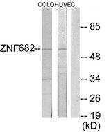 ZNF682 Antibody - Western blot analysis of extracts from COLO205 cells and HUVEC cells, using ZNF682 antibody.