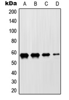 ZNF682 Antibody - Western blot analysis of ZNF682 expression in HeLa (A); Jurkat (B); NIH3T3 (C); H9C2 (D) whole cell lysates.