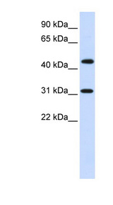 ZNF684 Antibody - ZNF684 antibody Western blot of Fetal Brain lysate. This image was taken for the unconjugated form of this product. Other forms have not been tested.