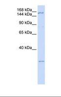 ZNF687 Antibody - 293T cell lysate. Antibody concentration: 1.0 ug/ml. Gel concentration: 6-18%.  This image was taken for the unconjugated form of this product. Other forms have not been tested.