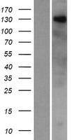 ZNF687 Protein - Western validation with an anti-DDK antibody * L: Control HEK293 lysate R: Over-expression lysate