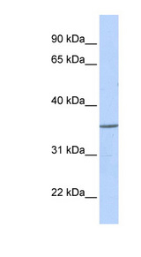 ZNF688 Antibody - ZNF688 antibody Western blot of Fetal Heart lysate. This image was taken for the unconjugated form of this product. Other forms have not been tested.