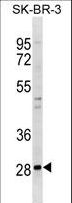 ZNF688 Antibody - ZNF688 Antibody western blot of SK-BR-3 cell line lysates (35 ug/lane). The ZNF688 antibody detected the ZNF688 protein (arrow).