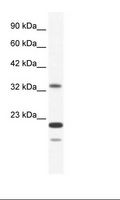 ZNF688 Antibody - Jurkat Cell Lysate.  This image was taken for the unconjugated form of this product. Other forms have not been tested.