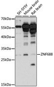 ZNF688 Antibody - Western blot analysis of extracts of various cell lines, using ZNF688 antibody at 1:1000 dilution. The secondary antibody used was an HRP Goat Anti-Rabbit IgG (H+L) at 1:10000 dilution. Lysates were loaded 25ug per lane and 3% nonfat dry milk in TBST was used for blocking. An ECL Kit was used for detection and the exposure time was 90s.