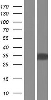ZNF688 Protein - Western validation with an anti-DDK antibody * L: Control HEK293 lysate R: Over-expression lysate