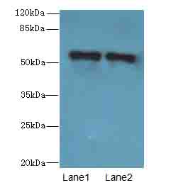 ZNF689 Antibody - Western blot. All lanes: ZNF689 antibody at 5 ug/ml. Lane 1: HeLa whole cell lysate. Lane 2: HepG-2 whole cell lysate. Secondary Goat polyclonal to Rabbit IgG at 1:10000 dilution. Predicted band size: 57 kDa. Observed band size: 57 kDa.