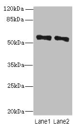 ZNF689 Antibody - Western blot All lanes: ZNF689 antibody at 5µg/ml Lane 1: Hela whole cell lysate Lane 2: HepG2 whole cell lysate Secondary Goat polyclonal to rabbit IgG at 1/10000 dilution Predicted band size: 57 kDa Observed band size: 57 kDa