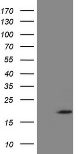 ZNF69 Antibody - HEK293T cells were transfected with the pCMV6-ENTRY control. (Left lane) or pCMV6-ENTRY ZNF69. (Right lane) cDNA for 48 hrs and lysed. Equivalent amounts of cell lysates. (5 ug per lane) were separated by SDS-PAGE and immunoblotted with anti-ZNF69. (1:2000)