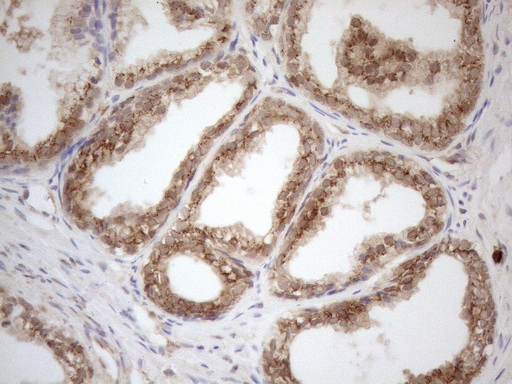 ZNF69 Antibody - Immunohistochemical staining of paraffin-embedded Human prostate tissue using anti-ZNF69 mouse monoclonal antibody. (Heat-induced epitope retrieval by 1mM EDTA in 10mM Tris buffer. (pH8.5) at 120°C for 3 min. (1:150)