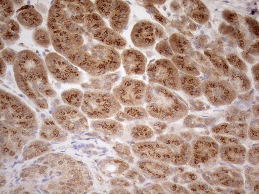ZNF69 Antibody - Immunohistochemical staining of paraffin-embedded Human pancreas tissue using anti-ZNF69 mouse monoclonal antibody. (Heat-induced epitope retrieval by 1mM EDTA in 10mM Tris buffer. (pH8.5) at 120°C for 3 min. (1:150)