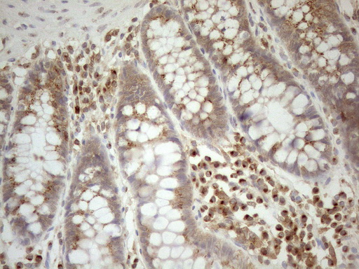 ZNF69 Antibody - Immunohistochemical staining of paraffin-embedded Human colon tissue using anti-ZNF69 mouse monoclonal antibody. (Heat-induced epitope retrieval by 1mM EDTA in 10mM Tris buffer. (pH8.5) at 120°C for 3 min. (1:150)
