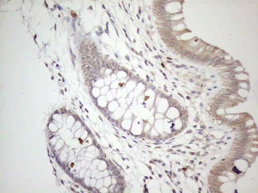 ZNF69 Antibody - Immunohistochemical staining of paraffin-embedded Human colon tissue within the normal limits using anti-ZNF69 mouse monoclonal antibody. (Heat-induced epitope retrieval by 1mM EDTA in 10mM Tris buffer. (pH8.5) at 120°C for 3 min. (1:150)