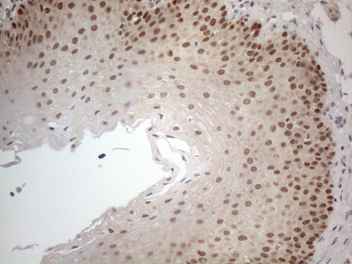 ZNF69 Antibody - Immunohistochemical staining of paraffin-embedded Human tonsil within the normal limits using anti-ZNF69 mouse monoclonal antibody. (Heat-induced epitope retrieval by 1mM EDTA in 10mM Tris buffer. (pH8.5) at 120°C for 3 min. (1:150)