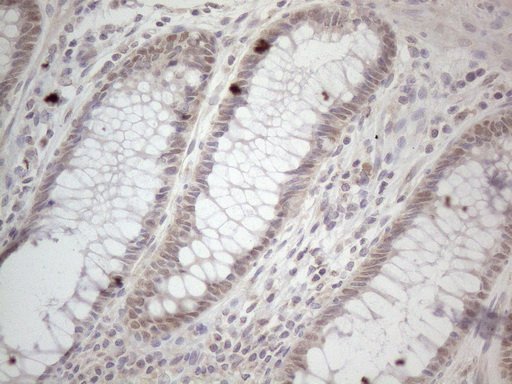 ZNF69 Antibody - Immunohistochemical staining of paraffin-embedded Human colon tissue within the normal limits using anti-ZNF69 mouse monoclonal antibody. (Heat-induced epitope retrieval by 1mM EDTA in 10mM Tris buffer. (pH8.5) at 120°C for 3 min. (1:150)