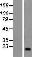 ZNF69 Protein - Western validation with an anti-DDK antibody * L: Control HEK293 lysate R: Over-expression lysate