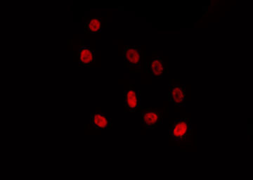 ZNF691 Antibody - Staining HepG2 cells by IF/ICC. The samples were fixed with PFA and permeabilized in 0.1% Triton X-100, then blocked in 10% serum for 45 min at 25°C. The primary antibody was diluted at 1:200 and incubated with the sample for 1 hour at 37°C. An Alexa Fluor 594 conjugated goat anti-rabbit IgG (H+L) Ab, diluted at 1/600, was used as the secondary antibody.