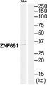 ZNF691 Antibody - Western blot analysis of extracts from HeLa cells, using ZNF691 antibody.