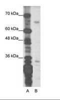 ZNF691 Antibody - A: Marker, B: Transfected 239T.  This image was taken for the unconjugated form of this product. Other forms have not been tested.