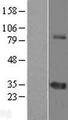 ZNF691 Protein - Western validation with an anti-DDK antibody * L: Control HEK293 lysate R: Over-expression lysate