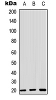 ZNF695 Antibody - Western blot analysis of ZNF695 expression in MCF7 (A); HeLa (B); HEK293T (C) whole cell lysates.