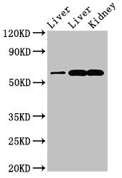 ZNF695 Antibody - Positive Western Blot detected in Rat liver tissue, Mouse liver tissue, Mouse kidney tissue. All lanes: ZNF695 antibody at 3.4 µg/ml Secondary Goat polyclonal to rabbit IgG at 1/50000 dilution. Predicted band size: 61, 21, 16, 11 KDa. Observed band size: 61 KDa