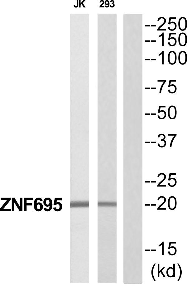 ZNF695 Antibody - Western blot analysis of extracts from Jurkat/293 cells, using ZNF695 antibody.