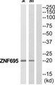 ZNF695 Antibody - Western blot analysis of extracts from Jurkat/293 cells, using ZNF695 antibody.