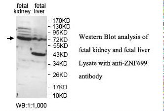 ZNF699 Antibody