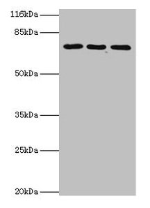 ZNF699 Antibody - Western blot All lanes: ZNF699 antibody at 2µg/ml Lane 1: jurkat cellsLane 2: K562 cells Lane 2: U87 cellsSecondary Goat polyclonal to rabbit IgG at 1/10000 dilution Predicted band size: 74 kDa Observed band size: 74 kDa
