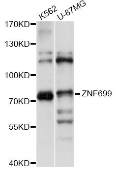 ZNF699 Antibody - Western blot analysis of extracts of various cell lines, using ZNF699 antibody at 1:1000 dilution. The secondary antibody used was an HRP Goat Anti-Rabbit IgG (H+L) at 1:10000 dilution. Lysates were loaded 25ug per lane and 3% nonfat dry milk in TBST was used for blocking. An ECL Kit was used for detection and the exposure time was 1s.