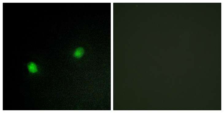 ZNF7 Antibody - Immunofluorescence analysis of HeLa cells, using ZNF7 Antibody. The picture on the right is blocked with the synthesized peptide.