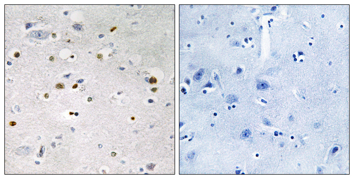 ZNF7 Antibody - Immunohistochemistry analysis of paraffin-embedded human brain tissue, using ZNF7 Antibody. The picture on the right is blocked with the synthesized peptide.