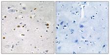 ZNF7 Antibody - Immunohistochemistry analysis of paraffin-embedded human brain tissue, using ZNF7 Antibody. The picture on the right is blocked with the synthesized peptide.