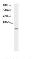 ZNF7 Antibody - Jurkat Cell Lysate.  This image was taken for the unconjugated form of this product. Other forms have not been tested.