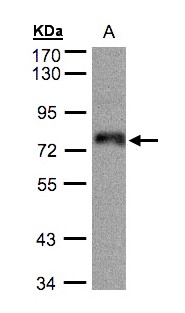 ZNF7 Antibody - Sample (30 ug whole cell lysate). A: A431. 7.5% SDS PAGE. ZNF7 antibody diluted at 1:500
