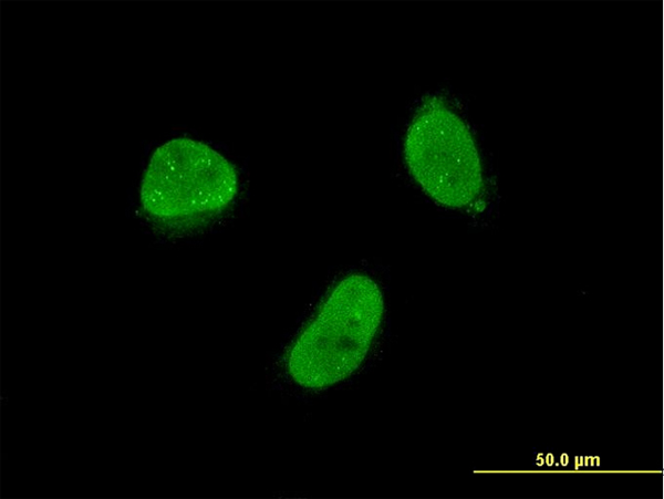ZNF7 Antibody - Immunofluorescence of monoclonal antibody to ZNF7 on HeLa cell . [antibody concentration 10 ug/ml]