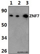 ZNF7 Antibody - Western blot of ZNF7 antibody at 1:500 dilution. Lane 1: HeLa whole cell lysate (40 ug). Lane 2: H9C2 whole cell lysate (40 ug). Lane 3: NIH-3T3 whole cell lysate (40 ug).