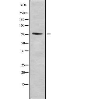 ZNF7 Antibody - Western blot analysis of ZNF7 using COLO205 whole cells lysates